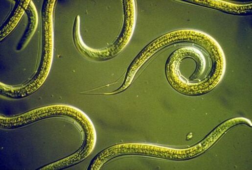 Parazitski crvi nematode u ljudskom tankom crijevu